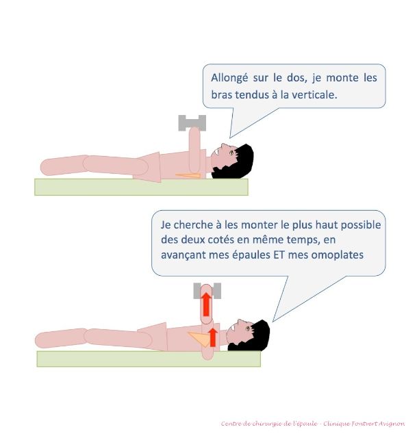 Travail du dentelé antérieur, épaule opérée coiffe, stades 2 et 3