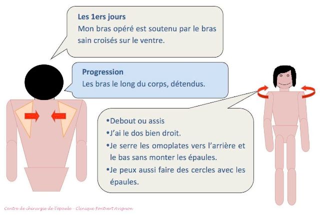 serrer omoplates_épaule opérée coiffe, stade 1
