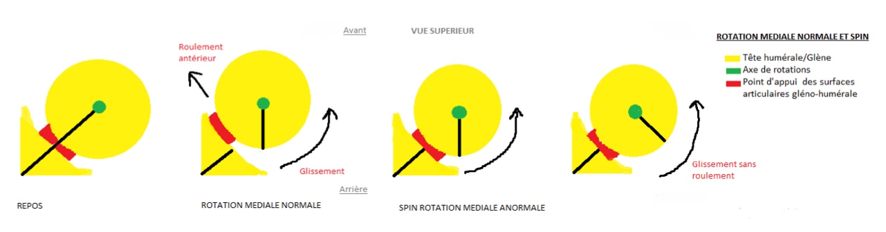 décentrage rotatoire de l'épaule ou spin