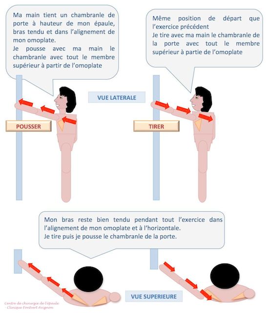 Travail statique Tirer Pousser, épaule opérée coiffe, stades 2 et 3